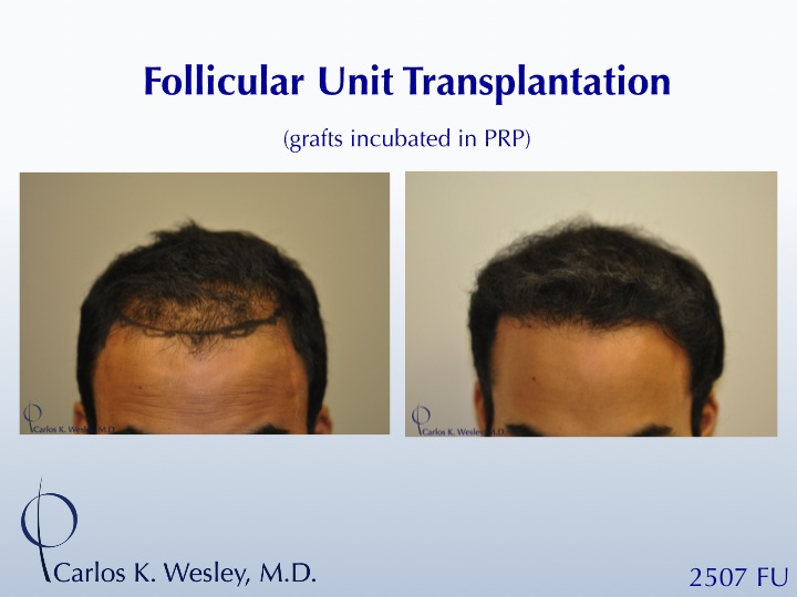 Slide1.jpg
