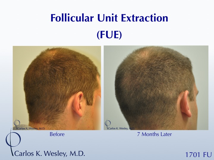 Slide11.jpg