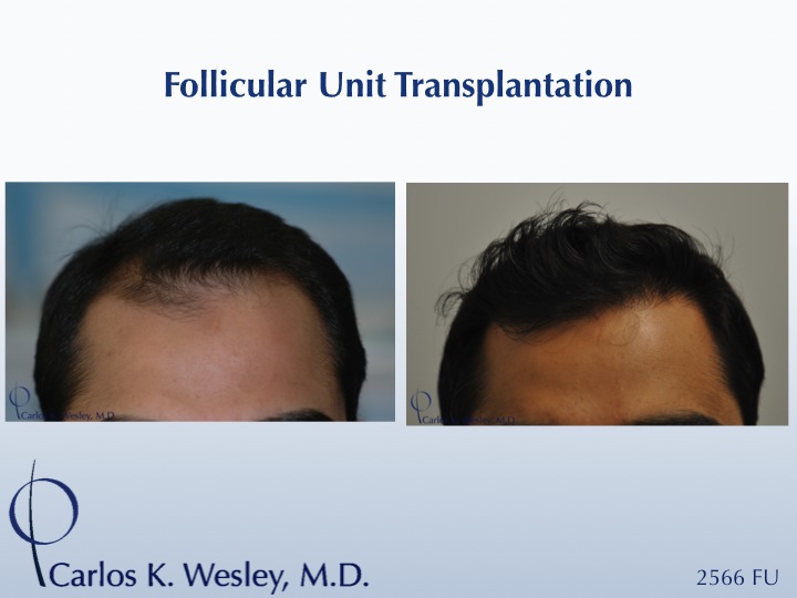 Slide1.jpg