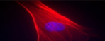 Follicular Unit Transplant, Micrografting, Hair Follicle, Hair Growth, Hair Surgery, 