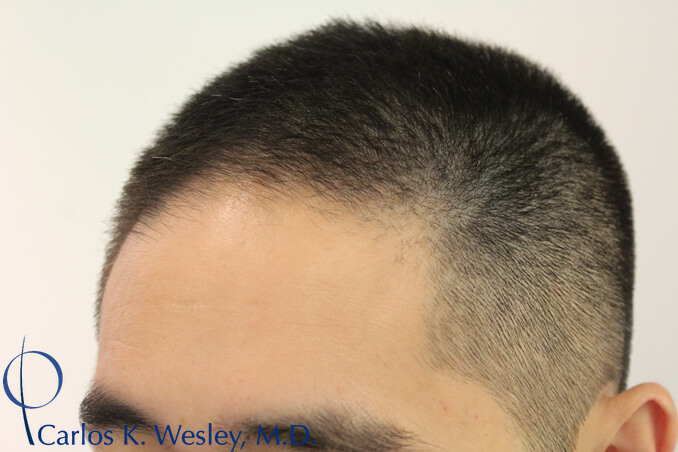 Before